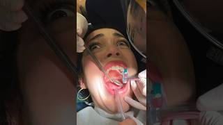 -Part2- Kardeşi̇m Di̇şleri̇mi̇ Yapiyor. İşkence Edi̇yor