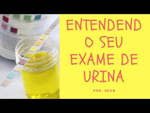 Vídeo: Análise Geral De Urina: A Norma, Que Mostra A Interpretação Dos Resultados