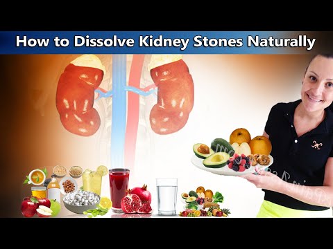 Dissolve Kidney Stones Naturally With These 8 Home Remedies