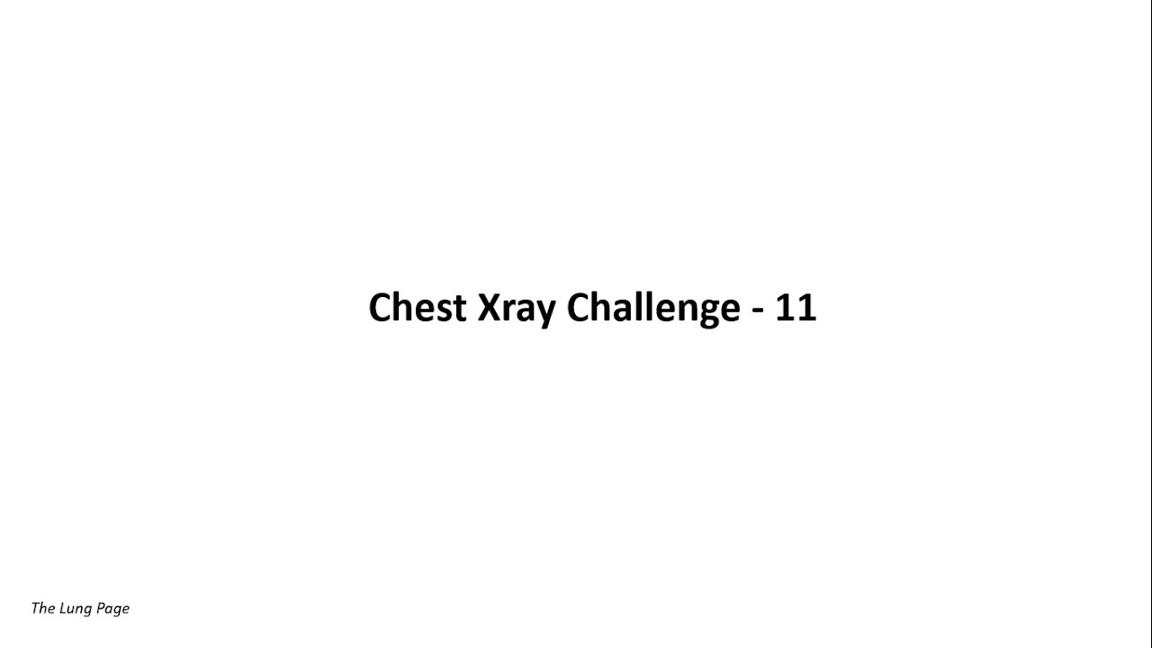 Chest X-ray Challenge - 11 - Air Under the Diaphragm