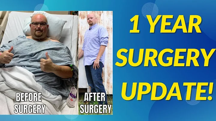 1 Year Update 🥳 Gastric Bypass Surgery!