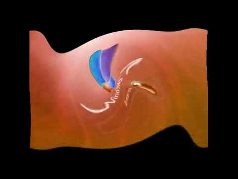 Windows 7 Effects 2 Lost Effect 