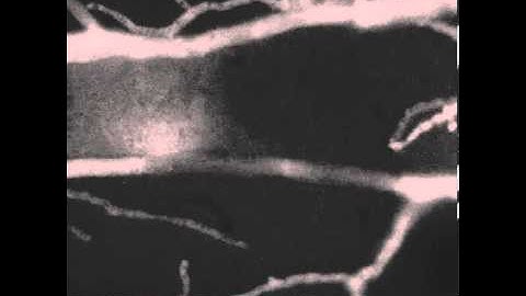 S3 Laser ablation of hyphae and subsequent localization of SOFT-GFP at  septal pores.