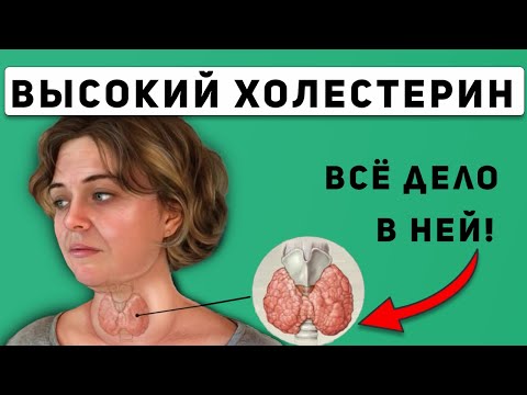 Холестерин и Гипотиреоз ( Щитовидная Железа )