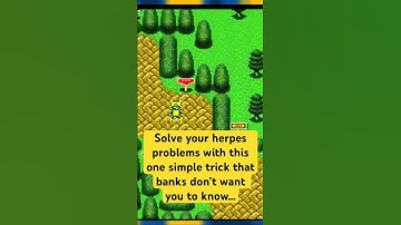 Solve herpes problems with this one simple trick that banks don’t want you to know #comedy #gaming