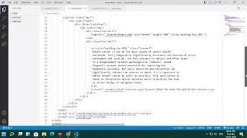 Cancer vision : Advanced breast cancer prediction with deep learning