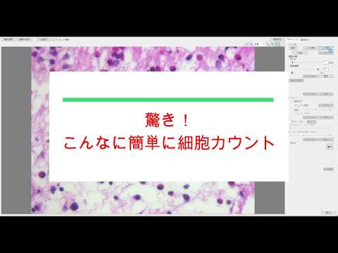 Patholoscopeシリーズ　細胞カウント機能紹介ムービー