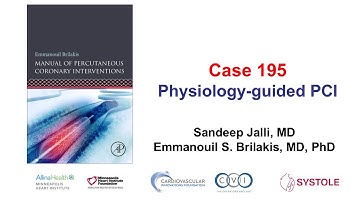 Case 195: Manual of PCI - Physiology-guided PCI