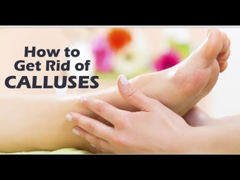 How to Remove Dry Skin from Your Feet Using Epsom Salt