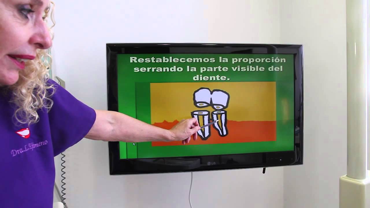 camera iphone 8 plus apk dentadura con anclaje-radicular