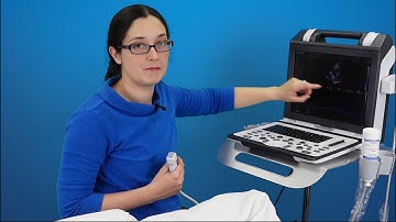 Human echocardiography: how to obtain the RV inflow view