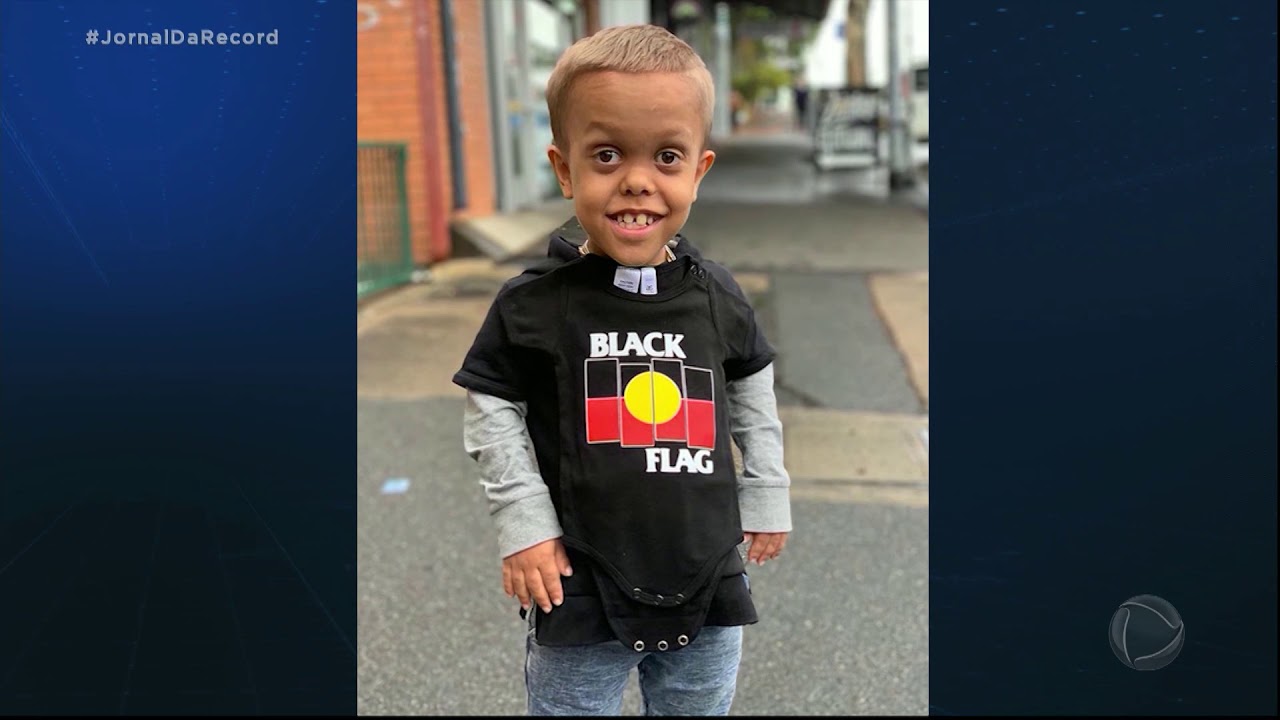 Desabafo de menino que sofre bullying por ter nanismo viraliza na internet