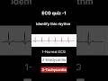 eCG quiz #ecginterpretation #ecglearning #viral