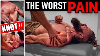 THE WORST PAIN YET!! Fixing 3 YEAR OLD Muscle Knot! | No More SHOULDER PAIN When Bench Pressing!