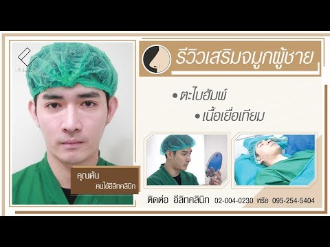 เสริมจมูก ผู้ชาย ทรง Elite clinic ตะไบฮัมพ์ให้สันจมูกเรียบสวย เสริมเนื้อเยื่อเทียม