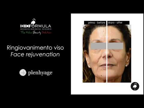 Video: Ringiovanimento In Cosmetologia