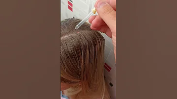 Как избавиться от укуса ВШЕЙ. Последствия укуса.