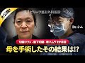 整形外科専門医が直接執刀して母の9ヶ月目の結果を公開！【切開リフト】