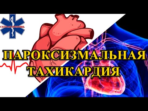 Бейне: Пароксизмальды тоник жоғарылауы жоғалады ма?