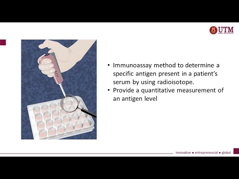 Radioimmunoassay (RIA) in