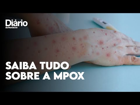 Mpox: Veja sintomas,