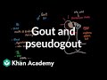 Understanding Gout and Pseudogout