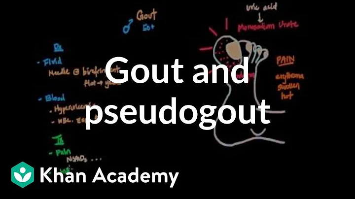 Gout and pseudogout | Muscular-skeletal diseases | NCLEX-RN | Khan Academy