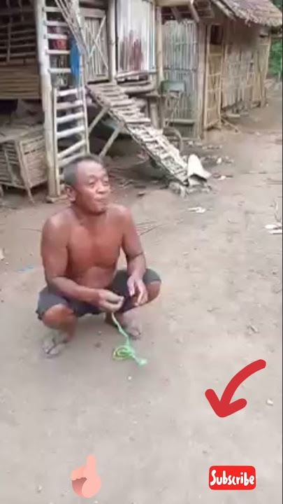 Apa Yang Terjadi Jika Tubuhmu di Gigit Ular, Tapi digigit Ular Lucu #shorts