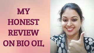 The honest review on Bio Oil/ how to get rid of stretch marks