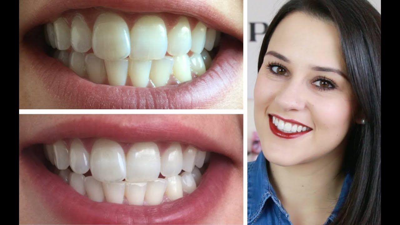 BLANCHIR SES DENTS en 3 semaines Cyrielle YouTube BLANCHIR SES DENTS en 3 semaines Cyrielle YouTube