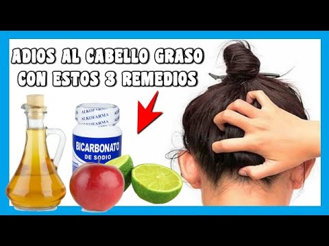 Vídeo: Cómo Deshacerse Del Cuero Cabelludo Y El Cabello Grasos: 16 Remedios Caseros