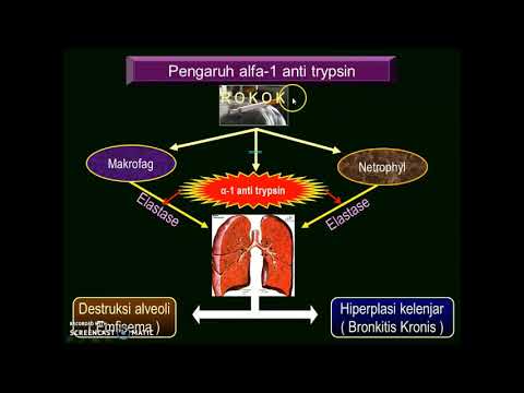 Video: Efek Dari Formula Herbal China San-Huang Gu-Ben Zhi-Ke Pengobatan Pada Penyakit Paru Obstruktif Kronis Yang Stabil: Protokol Studi Dari Uji Coba Acak, Tersamar Ganda, Terkontrol Pl