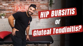 Hip Bursitis or Gluteal Tendinopathy:  The Important Difference & How to Treat Both