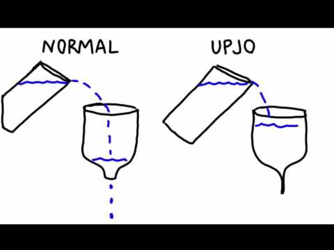 U-M Pediatric Urology - Ureteropelvic Junction Obstruction