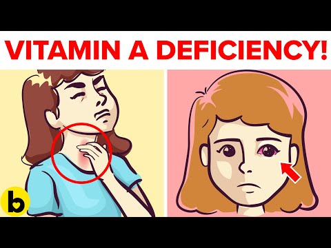 Video: Vitamin Hit På Avitaminose