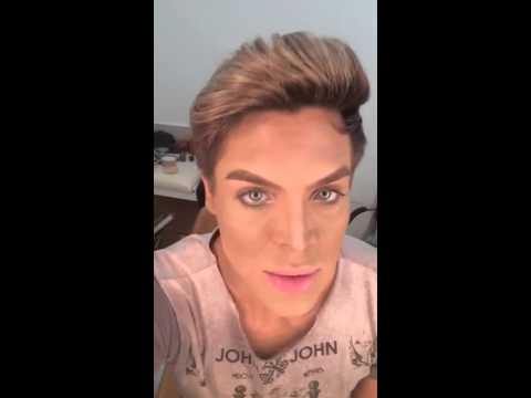 Bichectomia e Corn Lift - YouTube