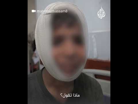 طفل فلسطيني: قصفونا ونحن نلعب