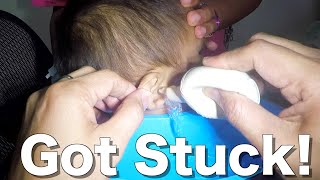 This is How to Remove a Bead Stuck in Boy's Ear by Earwax Specialist 18,396 views 3 months ago 1 minute, 7 seconds