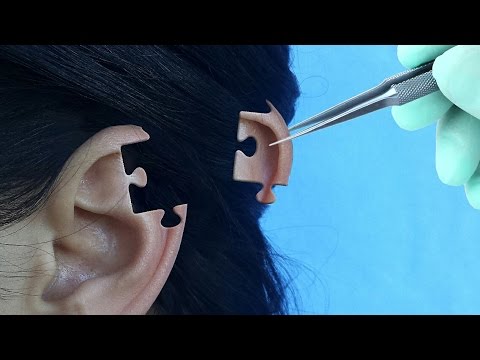 Reconstructia urechii | Ear reconstruction