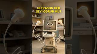 ULTRASONA GİRMEDEN İZLE! #ultrasound #shorts #keşfet #doktor #radyoloji #keşfetbeniöneçıkar