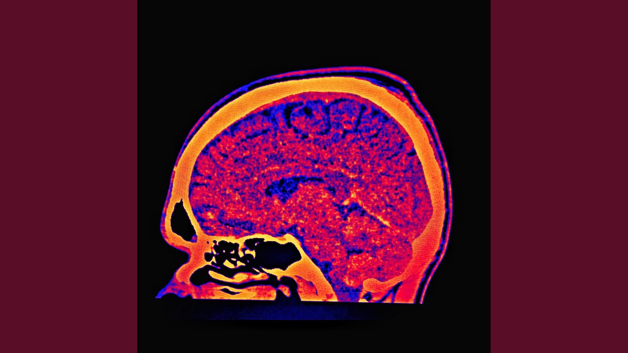 Watch Brain Screw on YouTube Watch Brain Screw on YouTube