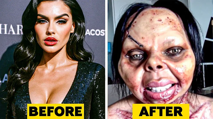 20 Celebrity Plastic Surgery Disasters