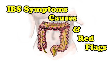 IBS Symptoms - Causes and Red Flags to be properly diagnosed with IBS