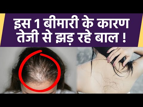 वीडियो: क्या टॉस करने और मुड़ने से बाल झड़ते हैं?