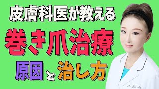 【巻き爪 治し方】巻き爪治療 原因と治し方を皮膚科医が教えます！