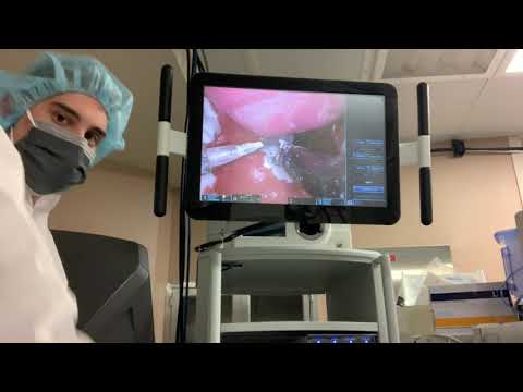 DaVinci SP Tongue Based Tumor Resection Simulation