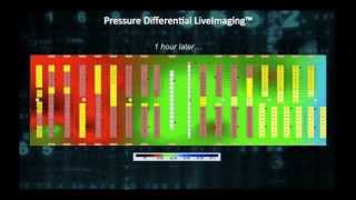 Pressure Differential LiveImaging