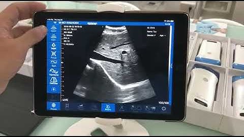 Phased Array Cardiac, Linear & Convex 3 in 1 Color Doppler Ultrasound Scanner 2 Convex