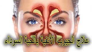 علاج الجيوب الأنفية باستخدام الحبة السوداء