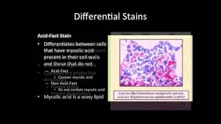 Differential Stains